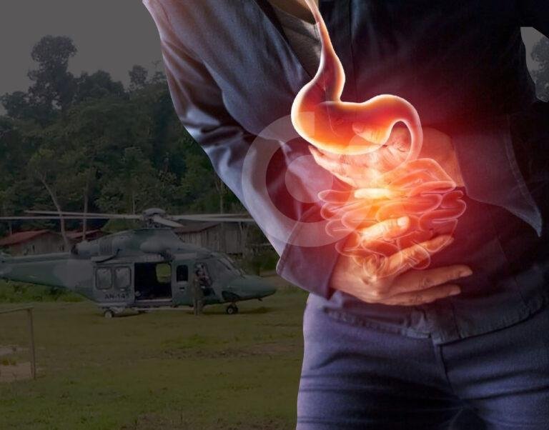 Brote de Gastroenteritis en la provincia de Colón